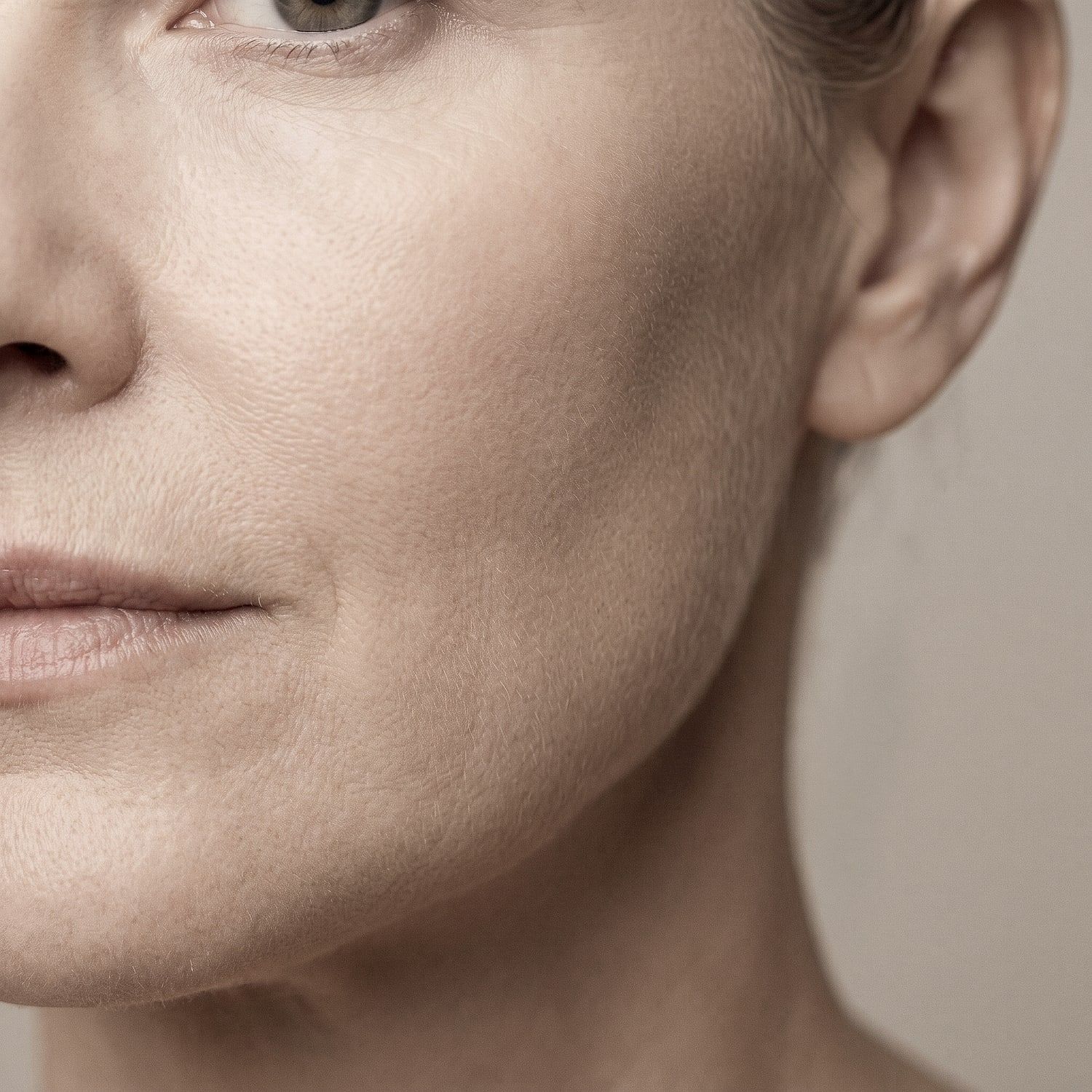 Flacidez facial
